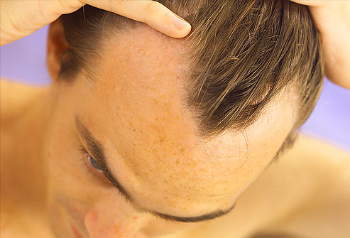brow hair loss symptoms causes